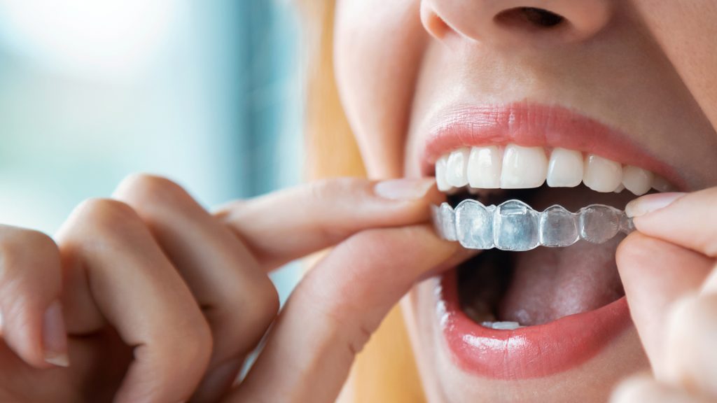 clínica Invisalign Dientes&Co