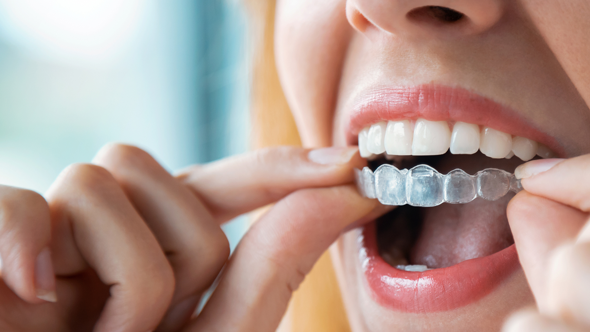 clínica Invisalign Dientes&Co